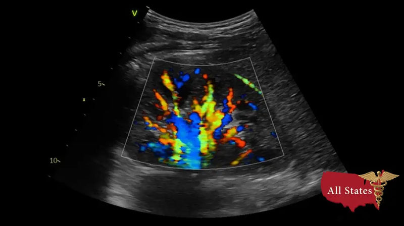 GE Vivid IQ Ultra Edition Portable Ultrasound-Ultrasounds-All States M.E.D.