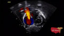 GE Vivid IQ Ultra Edition Portable Ultrasound-Ultrasounds-All States M.E.D.