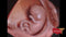 GE VOLUSON E8 Refurbished WITH 3 Probes-Ultrasounds-All States M.E.D.