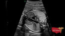 GE VOLUSON E8 Refurbished WITH 3 Probes-Ultrasounds-All States M.E.D.