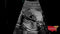 GE VOLUSON E8 Refurbished WITH 3 Probes-Ultrasounds-All States M.E.D.