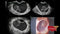 GE VOLUSON E8 Refurbished WITH 3 Probes-Ultrasounds-All States M.E.D.