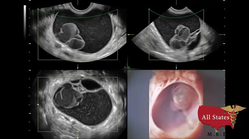 GE VOLUSON E8 Refurbished WITH 3 Probes-Ultrasounds-All States M.E.D.