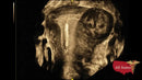 GE VOLUSON E8 Refurbished WITH 3 Probes-Ultrasounds-All States M.E.D.