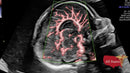 GE VOLUSON E8 Refurbished WITH 3 Probes-Ultrasounds-All States M.E.D.