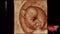 GE VOLUSON P8 BT22 Brand New-Ultrasounds-All States M.E.D.