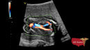 GE VOLUSON P8 BT22 Brand New-Ultrasounds-All States M.E.D.