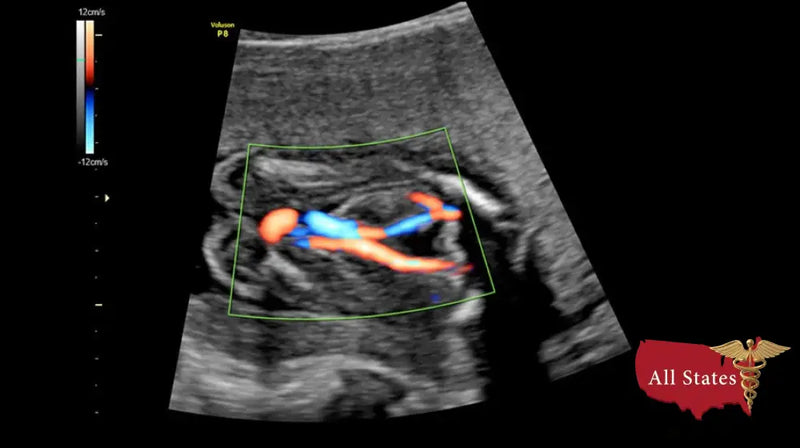 GE VOLUSON P8 BT22 Brand New-Ultrasounds-All States M.E.D.