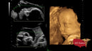 GE VOLUSON P8 BT22 Brand New-Ultrasounds-All States M.E.D.
