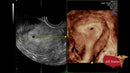 GE VOLUSON P8 BT22 Brand New-Ultrasounds-All States M.E.D.