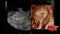 GE VOLUSON P8 BT22 Brand New-Ultrasounds-All States M.E.D.