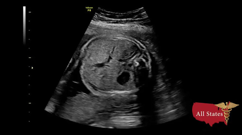 GE VOLUSON P8 BT22 Brand New-Ultrasounds-All States M.E.D.