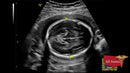 GE VOLUSON P8 BT22 Brand New-Ultrasounds-All States M.E.D.