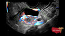 GE VOLUSON P8 BT22 Brand New-Ultrasounds-All States M.E.D.