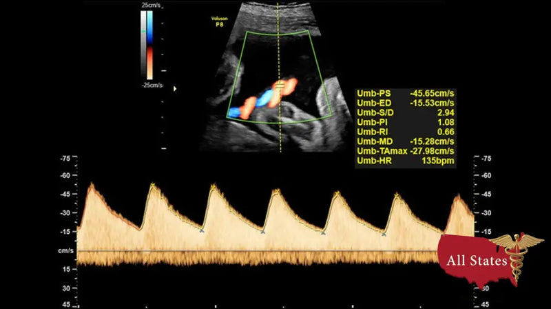 GE VOLUSON P8 BT22 Brand New-Ultrasounds-All States M.E.D.