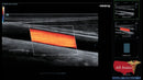 Mindray DC-70 FULL HD Ultrasound-Ultrasounds-All States M.E.D.