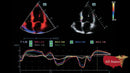 Mindray DC-70 FULL HD Ultrasound-Ultrasounds-All States M.E.D.