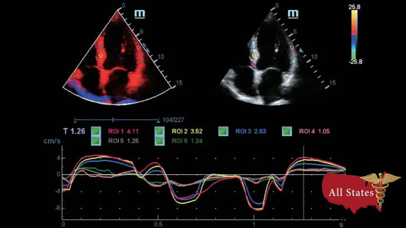 Mindray DC-70 FULL HD Ultrasound-Ultrasounds-All States M.E.D.