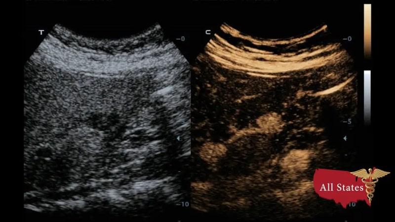 Mindray DC-70 FULL HD Ultrasound-Ultrasounds-All States M.E.D.