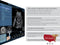 Mindray DC-70 FULL HD Ultrasound-Ultrasounds-All States M.E.D.
