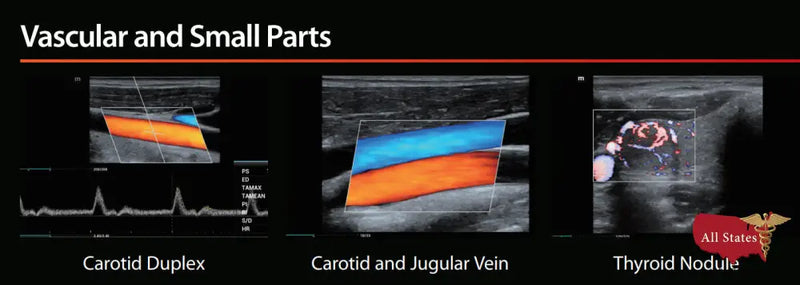 Mindray MX7 Ultrasound Brand New-Ultrasounds-All States M.E.D.