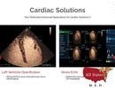 Mindray MX7 Ultrasound Cardiac Package 2 Probes-Ultrasounds-All States M.E.D.