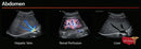 Mindray MX7 Ultrasound Cardiac Package 2 Probes-Ultrasounds-All States M.E.D.