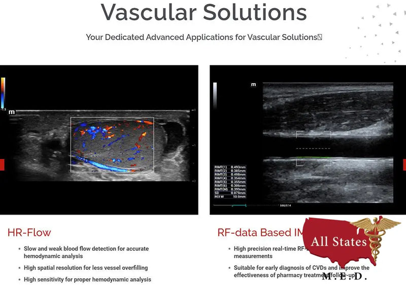 Mindray MX7 Ultrasound VASCULAR PACKAGE 1 Probe-Ultrasounds-All States M.E.D.