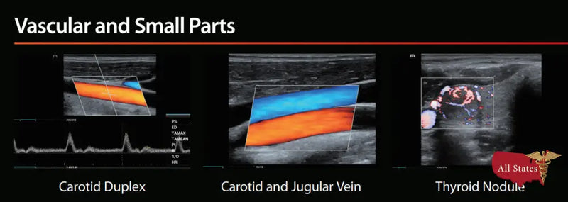 Mindray MX7 Ultrasound VASCULAR PACKAGE 1 Probe-Ultrasounds-All States M.E.D.
