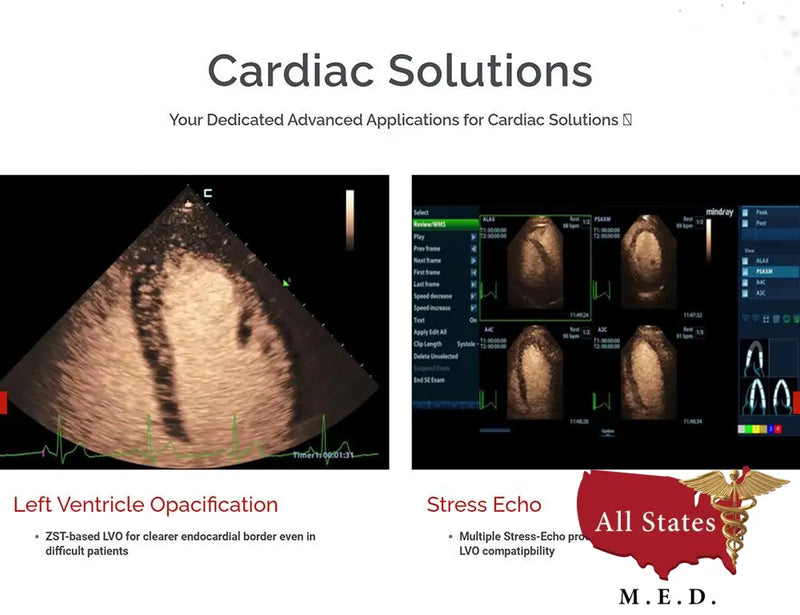 Mindray MX7 Ultrasound VASCULAR PACKAGE 1 Probe-Ultrasounds-All States M.E.D.