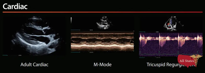 Mindray MX7 Ultrasound VASCULAR PACKAGE 1 Probe-Ultrasounds-All States M.E.D.