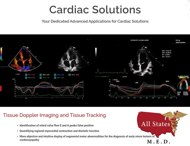 Mindray MX7 Ultrasound VASCULAR PACKAGE 1 Probe-Ultrasounds-All States M.E.D.