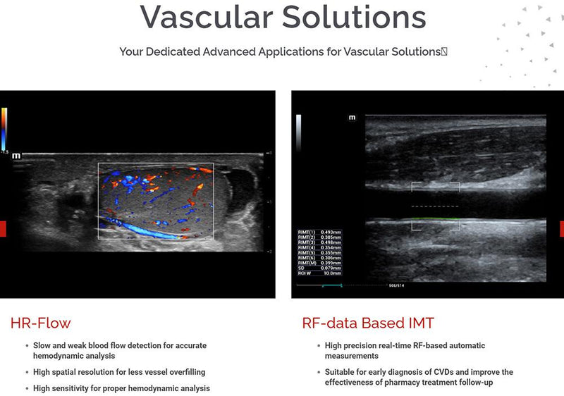 Mindray MX7 Ultrasound OBGYN Package 2 Probes