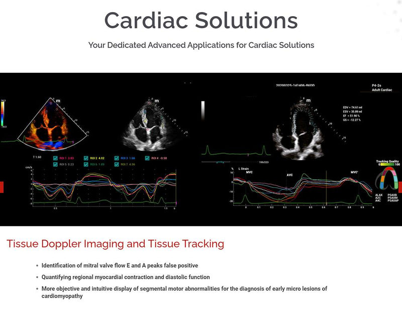 Mindray MX7 Ultrasound MSK Package 1 Probe