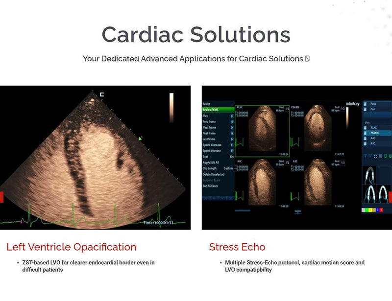 Mindray MX7 Ultrasound VASCULAR PACKAGE 1 Probe