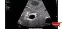Philips CX50 Refurbished with 3 Probes-Ultrasounds-All States M.E.D.