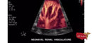 Philips CX50 Refurbished with 3 Probes-Ultrasounds-All States M.E.D.