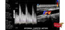 Philips CX50 Refurbished with 3 Probes-Ultrasounds-All States M.E.D.