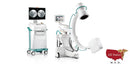 Ziehm Vision² C-Arm Fluoroscopy-C-Arms-All States M.E.D.
