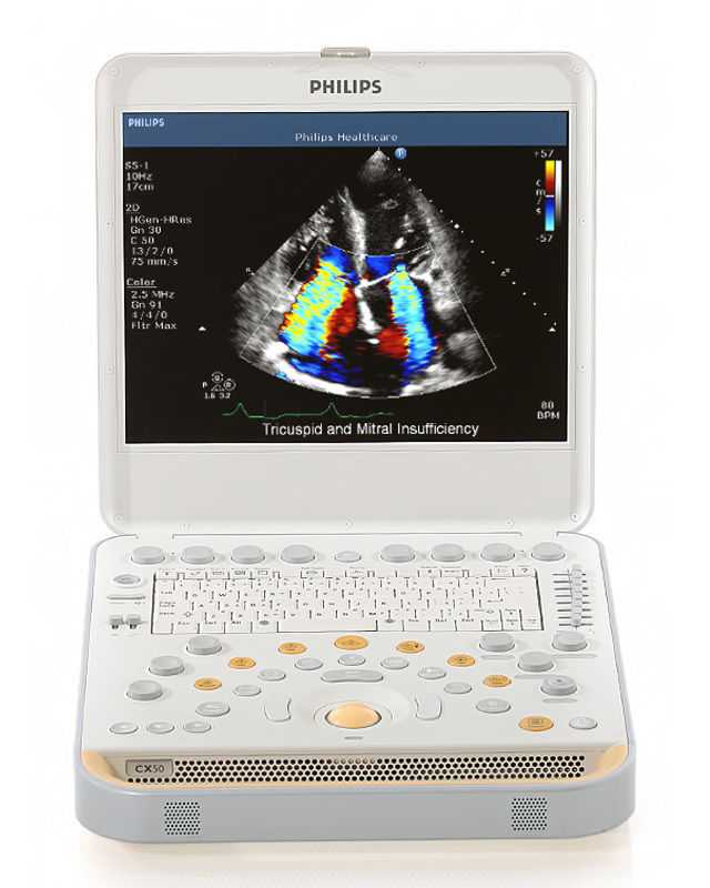 Philips CX50  Refurbished with 3 Probes