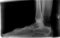 2020 Digital Plate Digital Podiatry Xray With 2018 Xcel Xray Platform