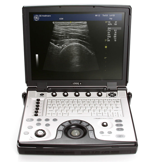 GE Logiq e Portable Ultrasound Machine REPAIR EVALUATION