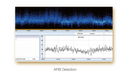 Edan SE 2003 / 2012 Holter monitor