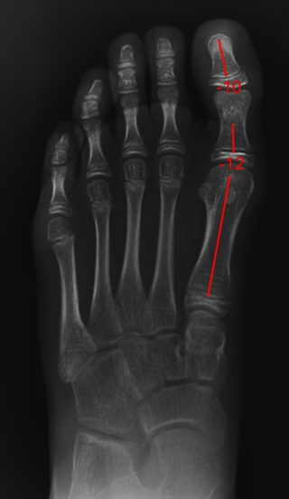 2020 Digital Plate Digital Podiatry Xray With 2018 Xcel Xray Platform