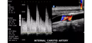 Philips CX50  Refurbished with 3 Probes